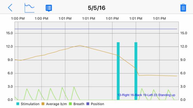 6 applications iPhone incontournables pour le traitement de l’apnée du sommeil