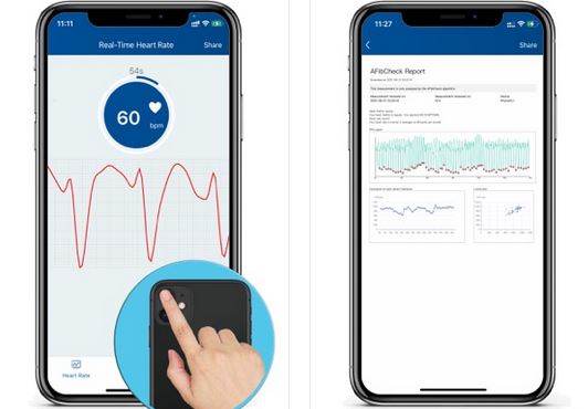 5 applications iPhone pour la détection et la gestion du fibrillation auriculaire