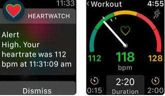 5 applications de sommeil pour Apple Watch