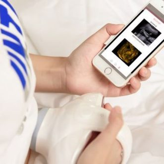 5 meilleures applications intelligentes de caméras fœtales et de moniteurs de grossesse