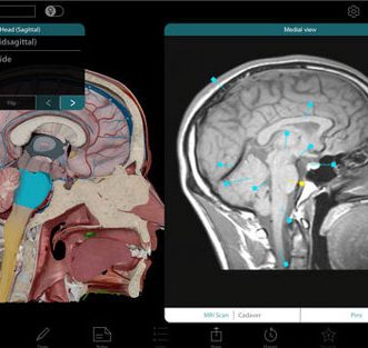 6 applications iPhone d’anatomie humaine 3D interactives