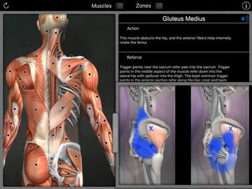 6 applications iPhone pour soulager les douleurs musculaires