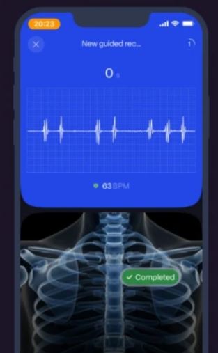 Stéthoscope sans fil intelligent Keikku App avec filtres