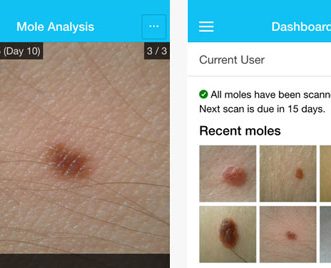 5 applications contre le cancer de la peau pour iPhone et iPad